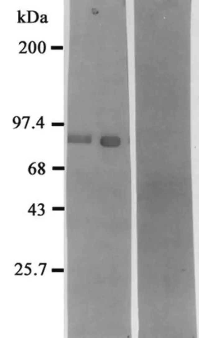 Anti-Neprilysin Antibody (Neutral Endopeptidase, Nep)