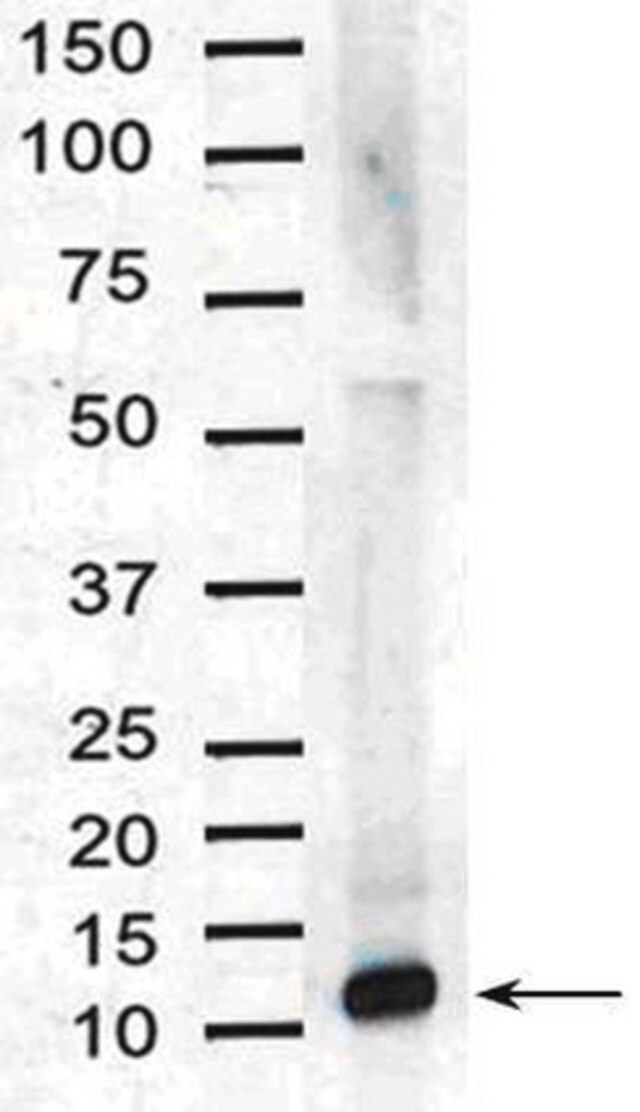 Anti-Interleukin-8 Antibody