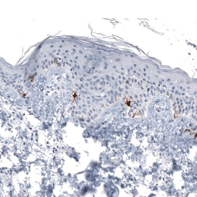 Monoclonal Anti-TYRP1 antibody produced in mouse