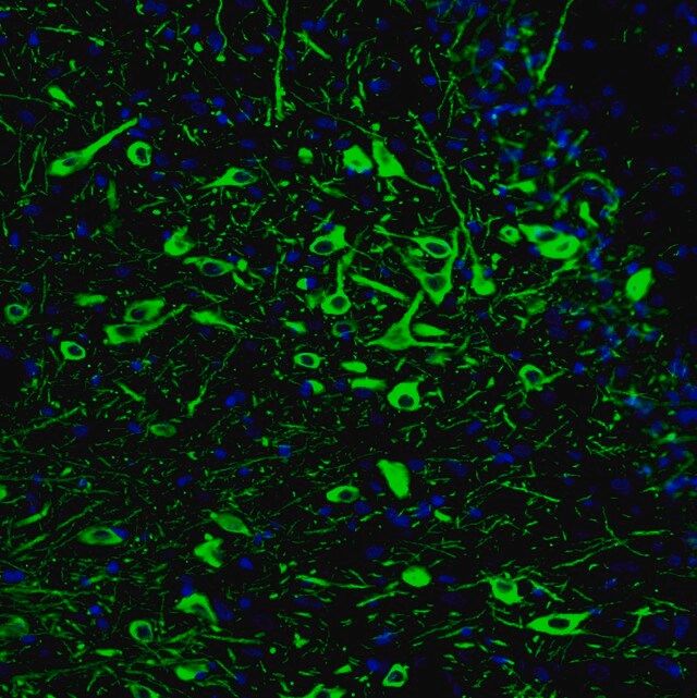 Monoclonal Anti-TPH2 antibody produced in mouse