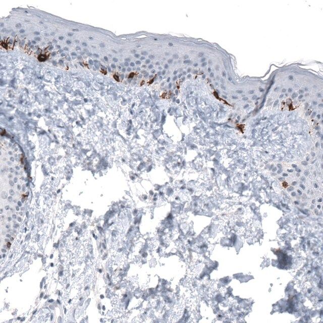 Monoclonal Anti-TYRP1 antibody produced in mouse