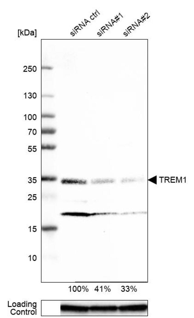 Monoclonal Anti-TREM1 antibody produced in mouse