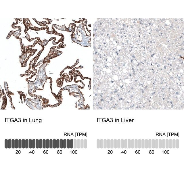 Monoclonal Anti-ITGA3 antibody produced in mouse