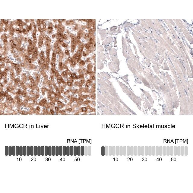 Monoclonal Anti-HMGCR antibody produced in mouse