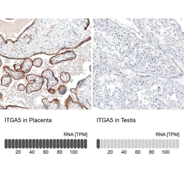 Monoclonal Anti-ITGA5 antibody produced in mouse