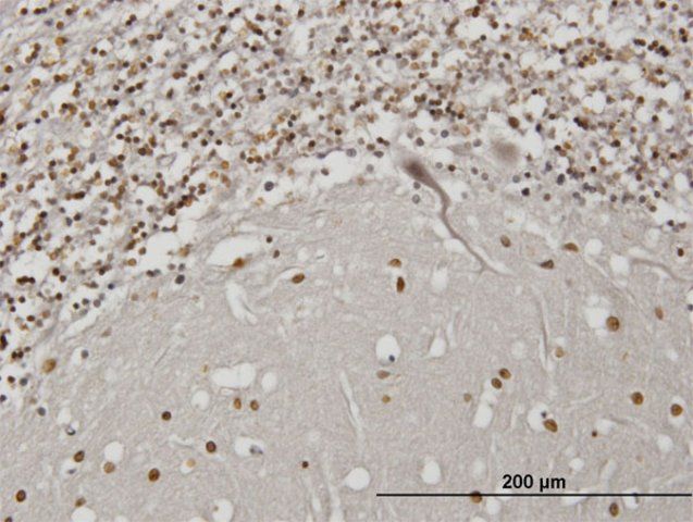 Monoclonal Anti-IBRDC2 antibody produced in mouse