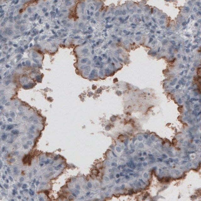 Monoclonal Anti-MUC16 antibody produced in mouse