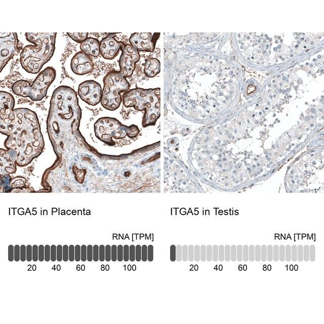 Monoclonal Anti-ITGA5 antibody produced in mouse