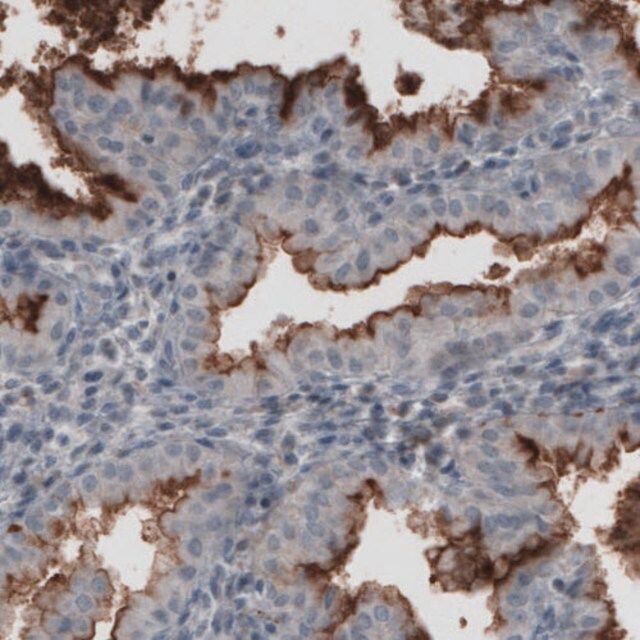 Monoclonal Anti-MUC16 antibody produced in mouse