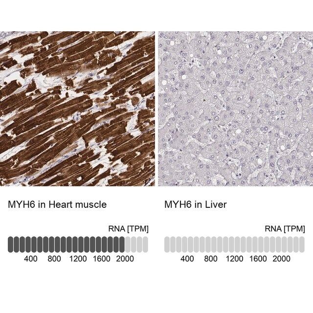 Monoclonal Anti-MYH6 antibody produced in mouse