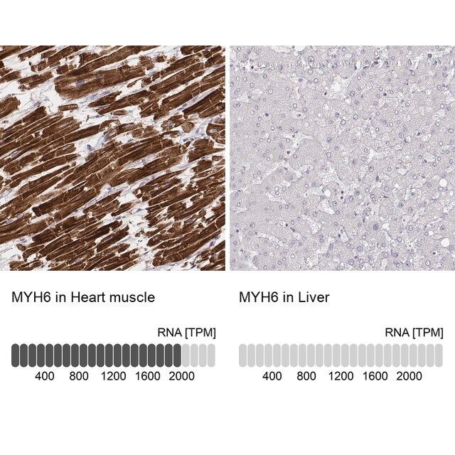 Monoclonal Anti-MYH6 antibody produced in mouse