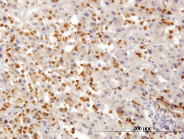 Monoclonal Anti-TARS antibody produced in mouse