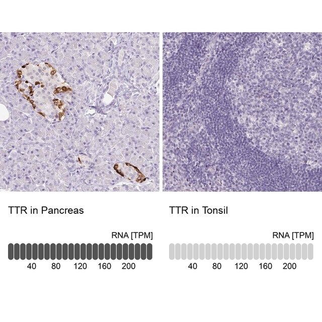 Monoclonal Anti-TTR antibody produced in mouse