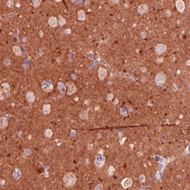 Monoclonal Anti-TSPAN7 antibody produced in mouse