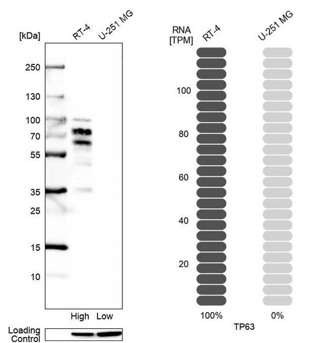 Monoclonal Anti-TP63 antibody produced in mouse