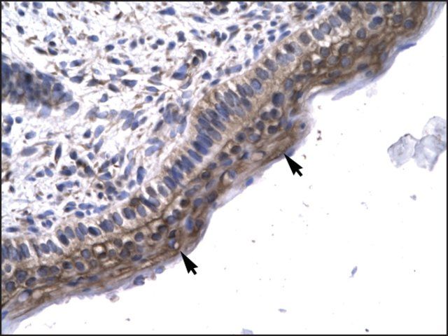 Anti-LEF1 (AB1) antibody produced in rabbit