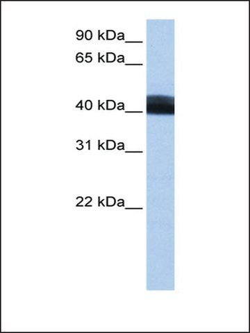 Anti-LRRC17 antibody produced in rabbit