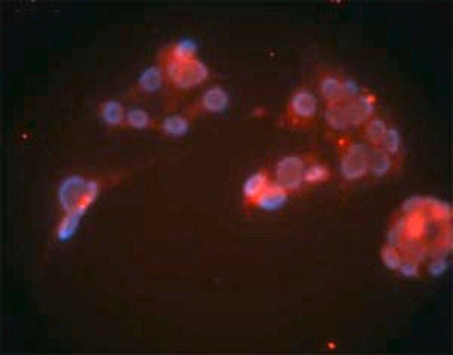 Anti-LDL Receptor Mouse mAb (15C8)