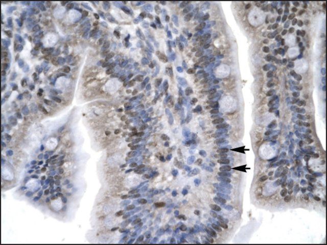 Anti-LEF1 (AB2) antibody produced in rabbit