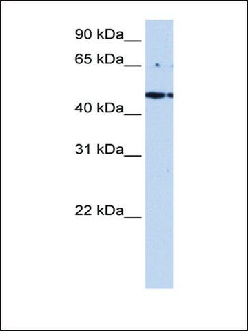 Anti-LYK5 antibody produced in rabbit