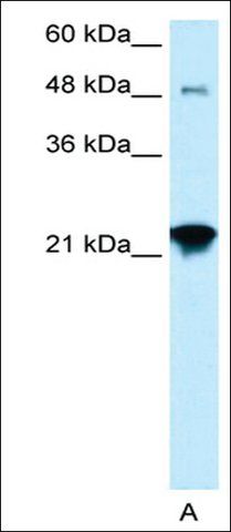 Anti-LASS2 antibody produced in rabbit