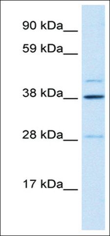 Anti-LASS3 antibody produced in rabbit