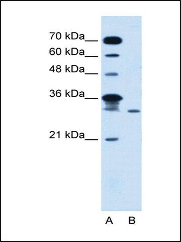 Anti-LOC388323 antibody produced in rabbit