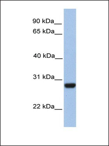 Anti-PAOX (AB2) antibody produced in rabbit