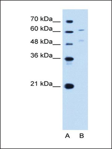 Anti-UGT1A4 antibody produced in rabbit