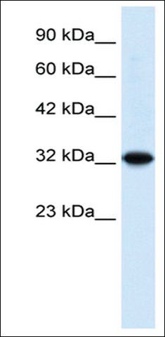 Anti-ZBTB32 antibody produced in rabbit