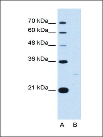 Anti-YWHAZ antibody produced in rabbit