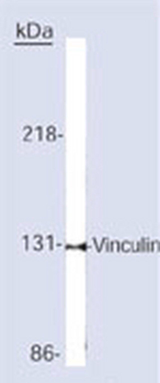 Anti-Vinculin Mouse mAb (V284 or VLN01)