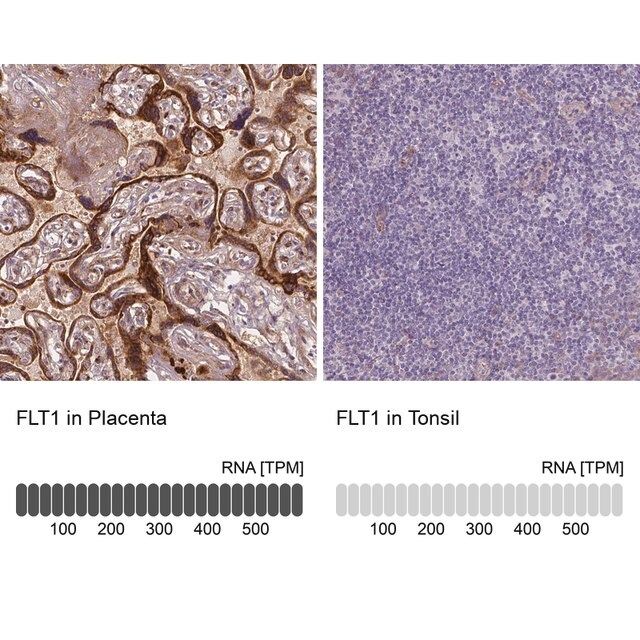 Monoclonal Anti-FLT1 antibody produced in mouse