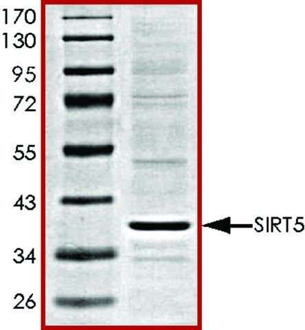 SIRT5, active, His tagged human