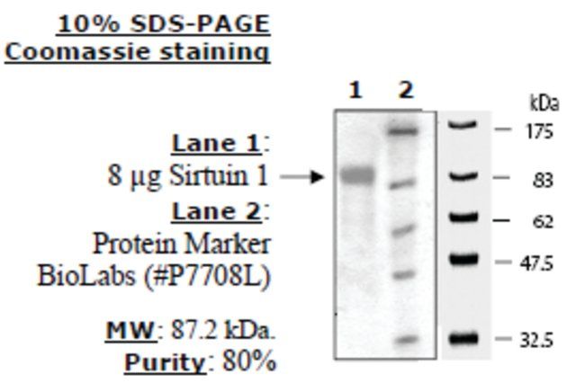 Sirtuin 1 human