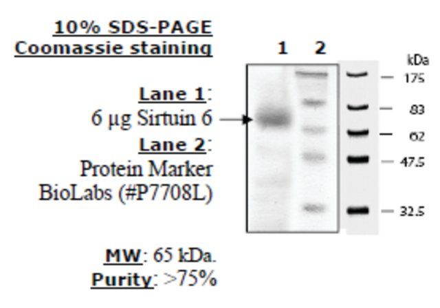 Sirtuin 6 human