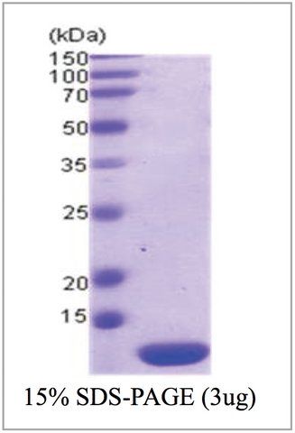 Thioredoxin 2 human