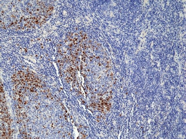 TOP2A (Topoisomerase II) Rabbit Monoclonal Antibody