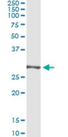 Monoclonal Anti-TRIM72, (C-terminal) antibody produced in mouse