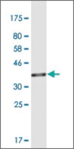 Monoclonal Anti-TSFM antibody produced in mouse