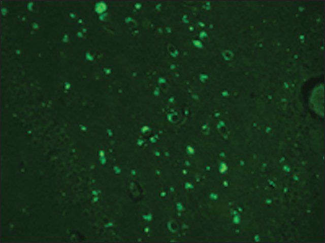 Monoclonal Anti-TRPC4 antibody produced in mouse