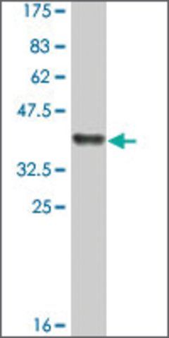 Monoclonal Anti-TSNAX, (C-terminal) antibody produced in mouse