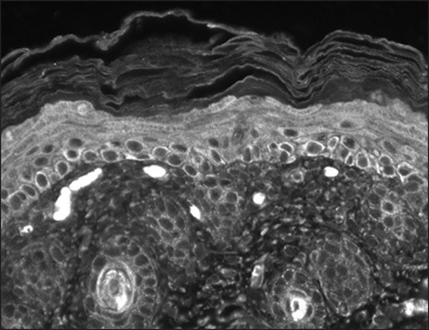 Monoclonal Anti-TRPC7 antibody produced in mouse