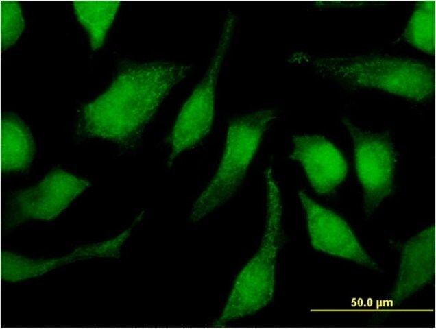 Monoclonal Anti-TRIM47, (C-terminal) antibody produced in mouse