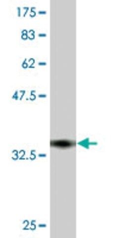 Monoclonal Anti-TRPV5, (N-terminal) antibody produced in mouse