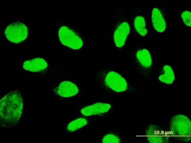 Monoclonal Anti-TSPYL1, (N-terminal) antibody produced in mouse