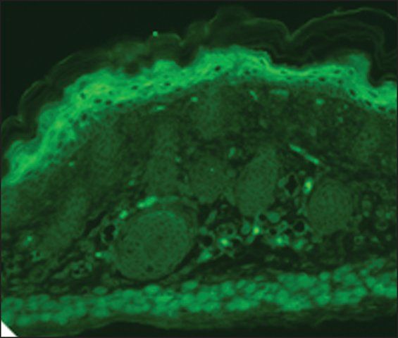 Monoclonal Anti-TRPV3 antibody produced in mouse