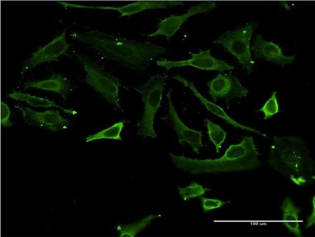 Monoclonal Anti-TSSK3 antibody produced in mouse