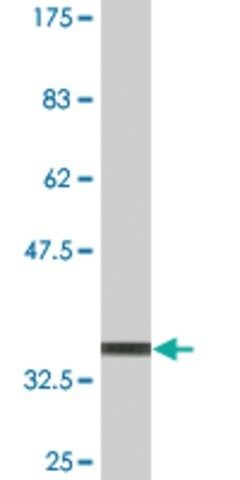 Monoclonal Anti-TREX1, (N-terminal) antibody produced in mouse