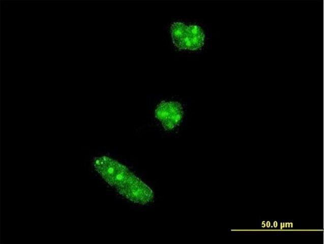 Monoclonal Anti-TWIST1 antibody produced in mouse